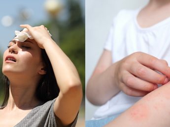 awareness about sunburn prevention and the importance of maintaining skin health and safety.